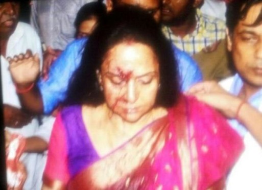 Veteran Bollywood Actress Hema Malini injured in car accident